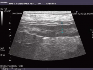 Fig 2 - Ultrasound
